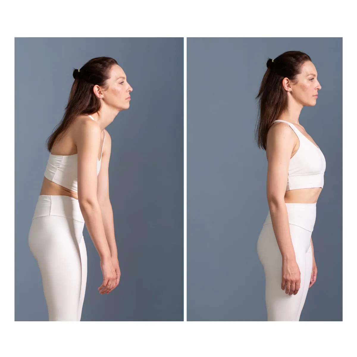 Rounded Shoulders