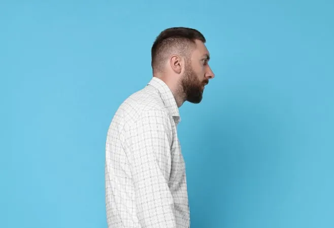 Forward Head Posture